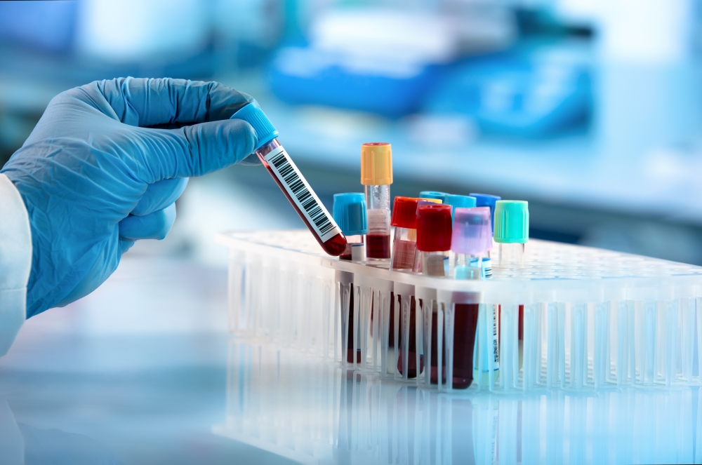 Laboratori di Analisi